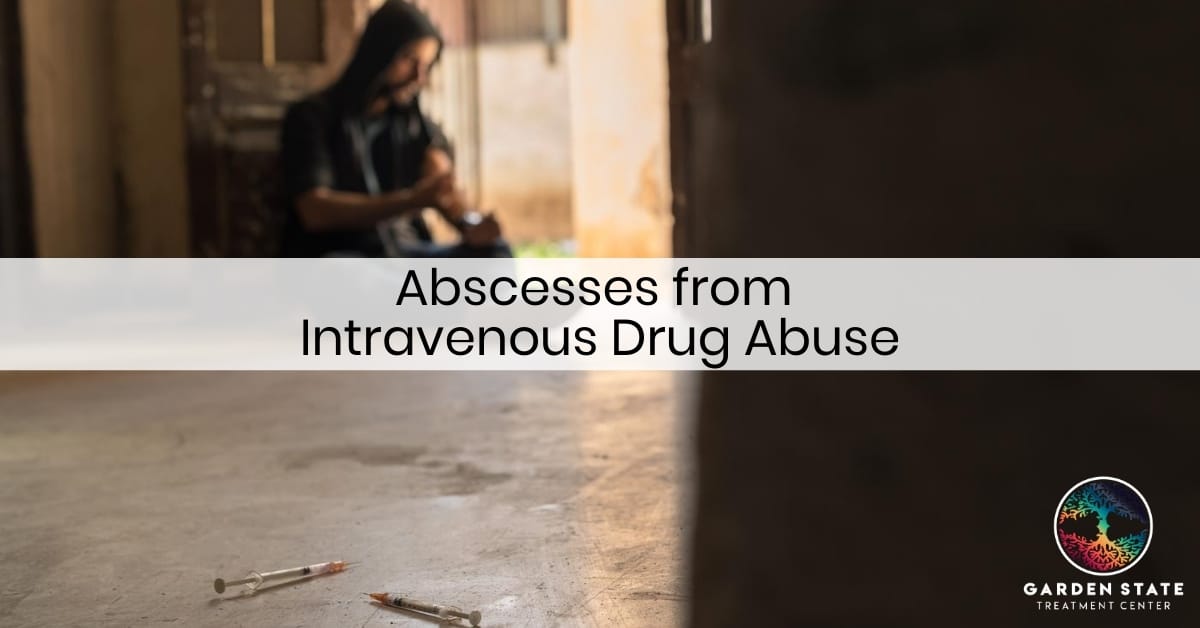 Abscesses from Intravenous Drug Abuse