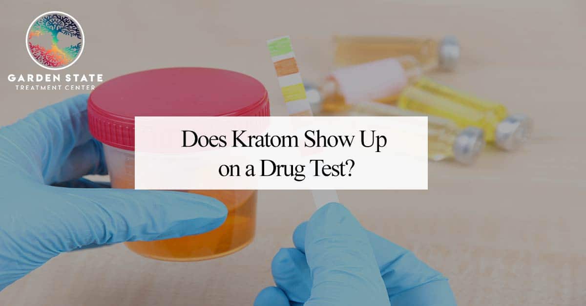 Does Kratom Show Up on a Drug Test?