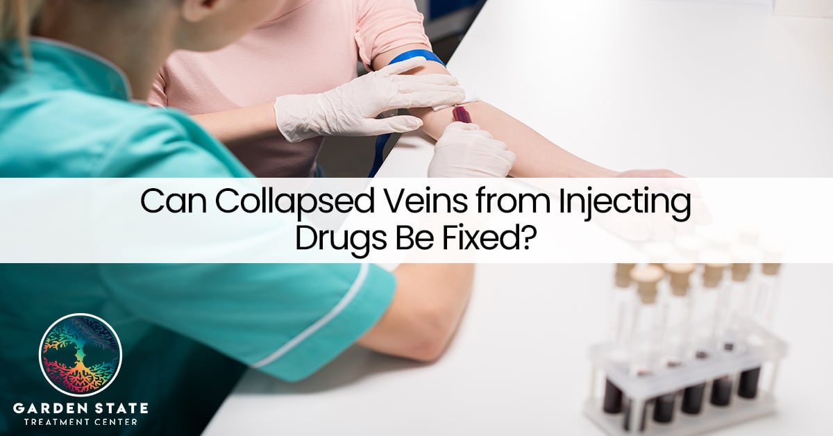 Can Collapsed Veins from Injecting Drugs Be Fixed?