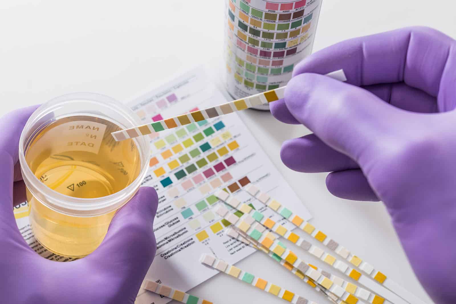 How Far Back does a Lab Urine Test Go?