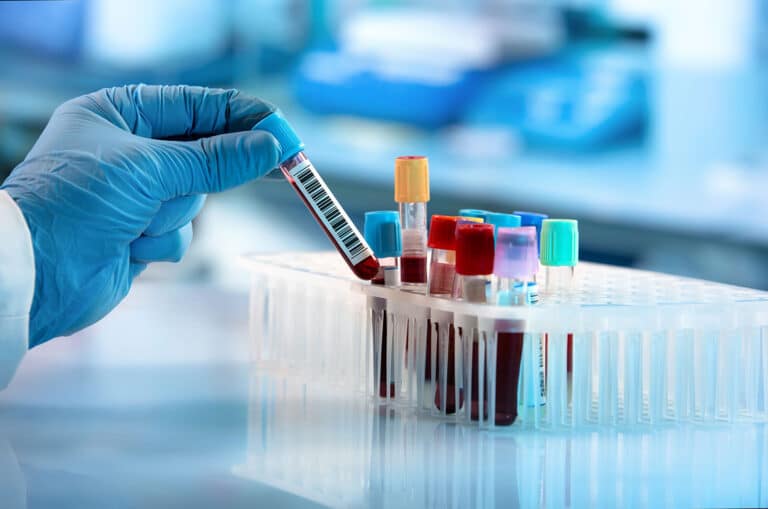 Do regular blood tests show drugs? - Garden State Treatment Center - Does Weed Show Up In Regular Blood Tests