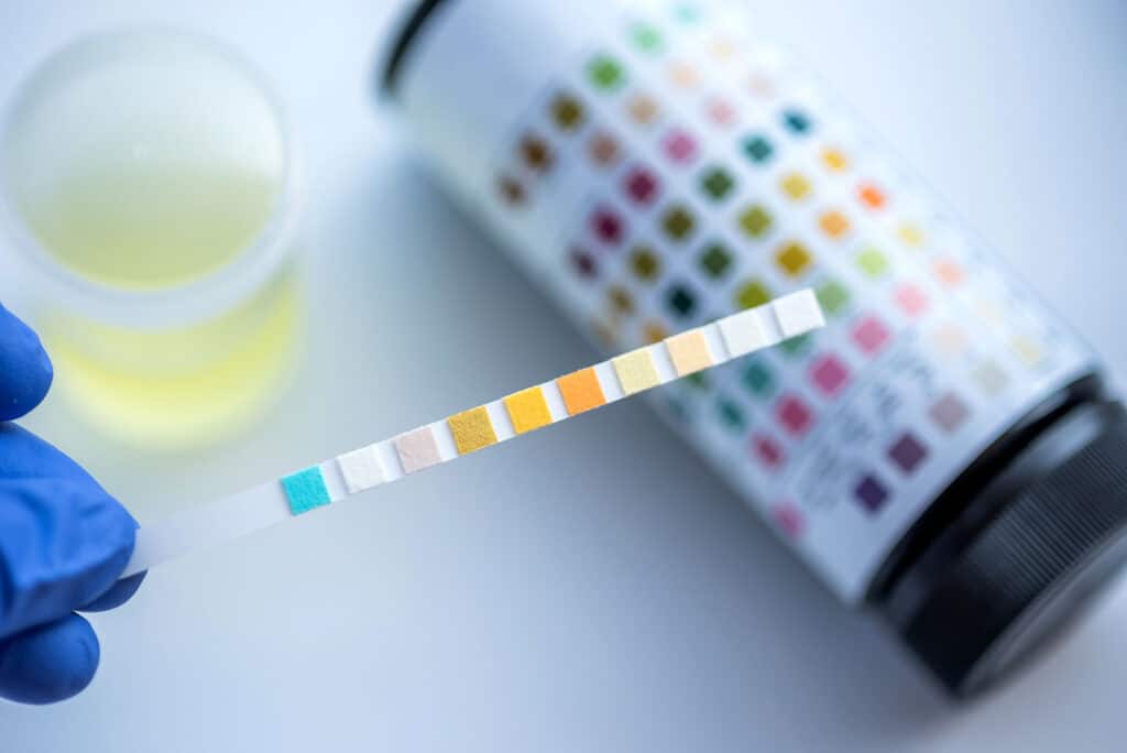 Urine Drug Testing